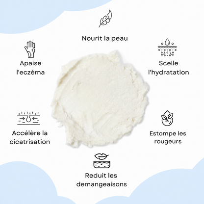 Chantilly Karité | Eczema & Peaux Réactives