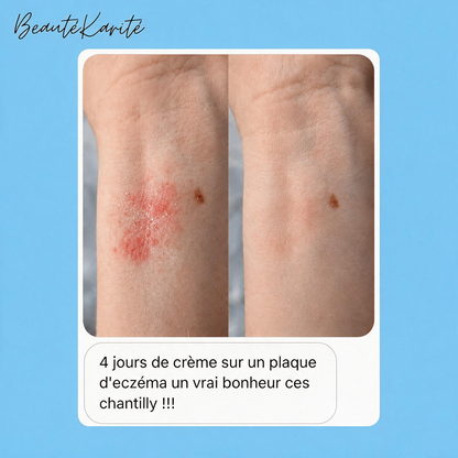 Chantilly Karité | Eczema & Peaux Réactives